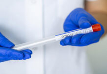 Bu gün 530 yeni yoluxma faktı qeydə alınıb yoluxma-koronavirus