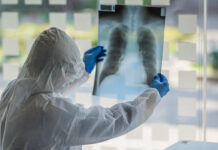 Buzlu şüşə diaqnozu qoyulan koronavirus xəstələri nə etməlidirlər? – Həkimdən AÇIQLAMA buzlu-suse-koronavirus-covid